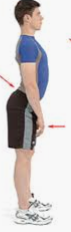 lumbar lordosis.PNG