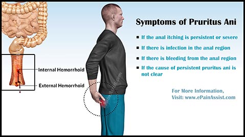 symptoms-of-pruritus.jpg