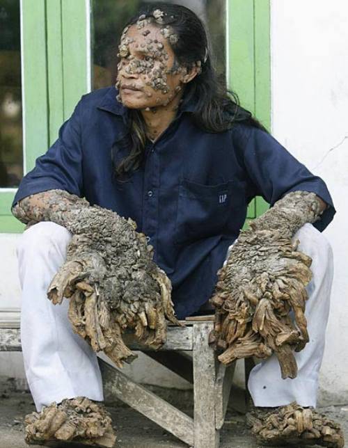 human-tree-man12.jpg
